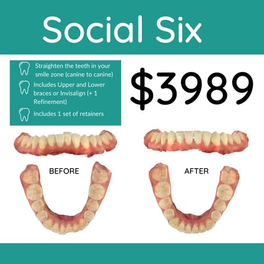 Social Six Ad